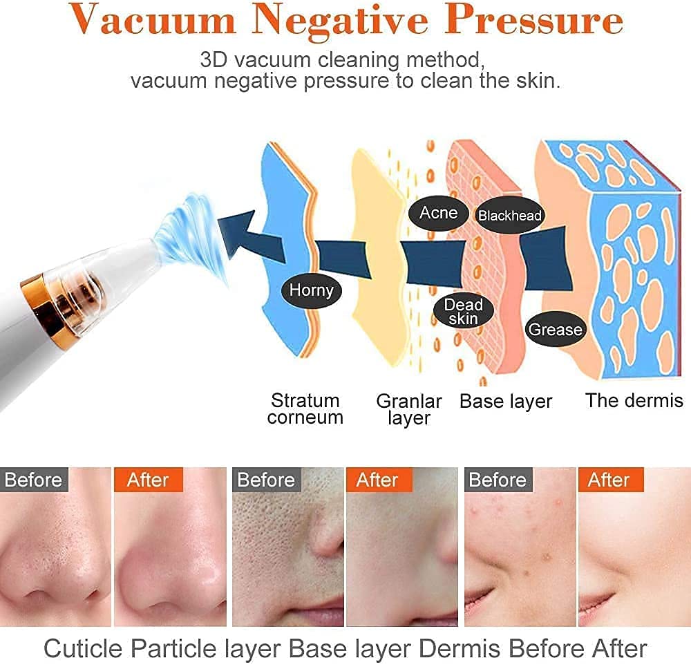 Glow effortlessly with the Blackhead Removal Machine